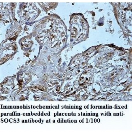 SOCS3 Antibody