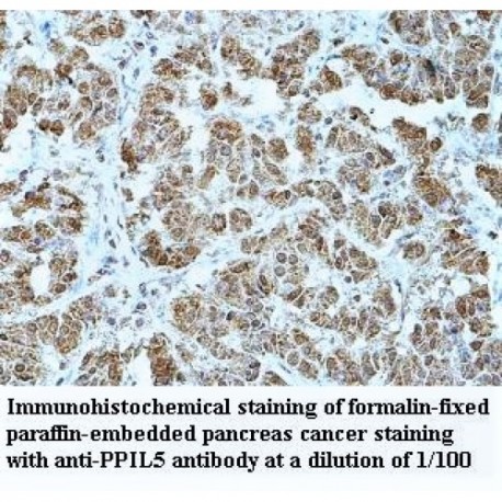 PPIL5 Antibody