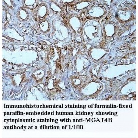 MGAT4B Antibody