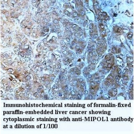 MIPOL1 Antibody