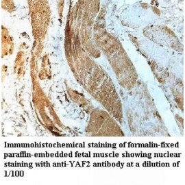 YAF2 Antibody