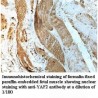 YAF2 Antibody