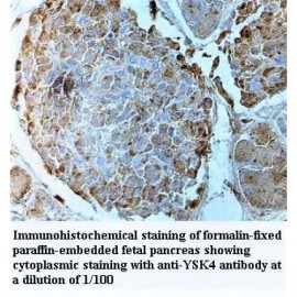 YSK4 Antibody