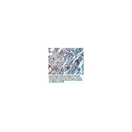 MIPOL1 Antibody
