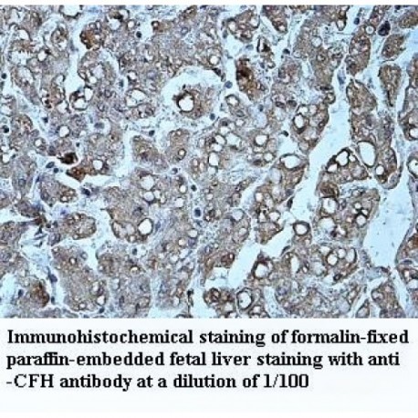 CFH Antibody