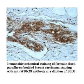 WDR31 Antibody