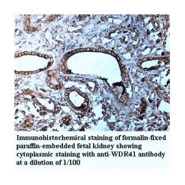 WDR31 Antibody