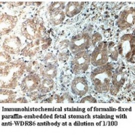 WDR86 Antibody