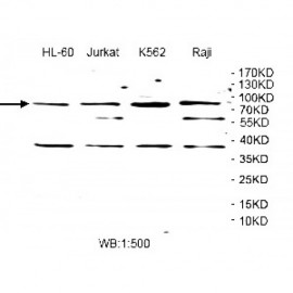 WDTC1 Antibody