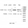 WDTC1 Antibody