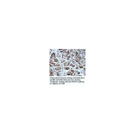 MIPOL1 Antibody