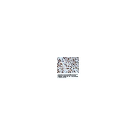 MIPOL1 Antibody
