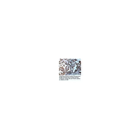 MIPOL1 Antibody