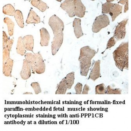 PPP1CB Antibody