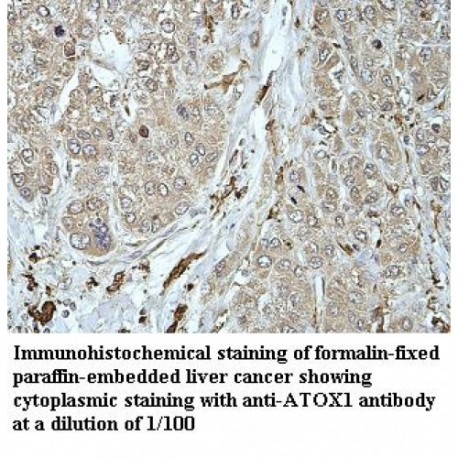 ATOX1 Antibody