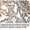 WFDC9 Antibody