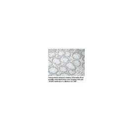 WDR86 Antibody