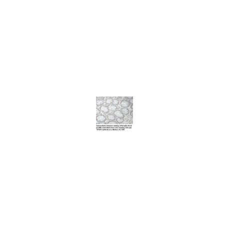 WDR86 Antibody