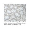 WISP3 Antibody