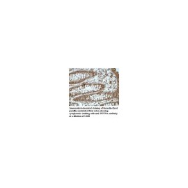 WHSC1L1 Antibody