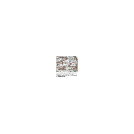 WHSC1L1 Antibody