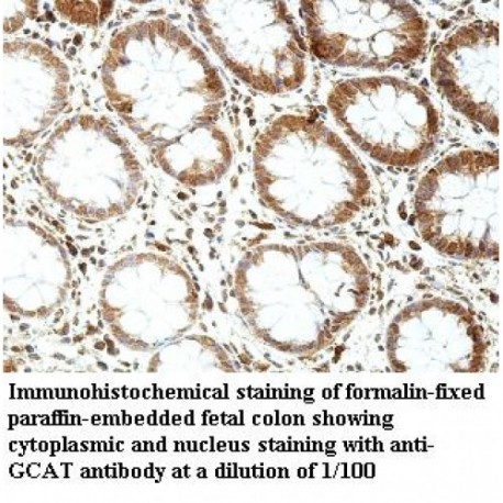 GCAT Antibody