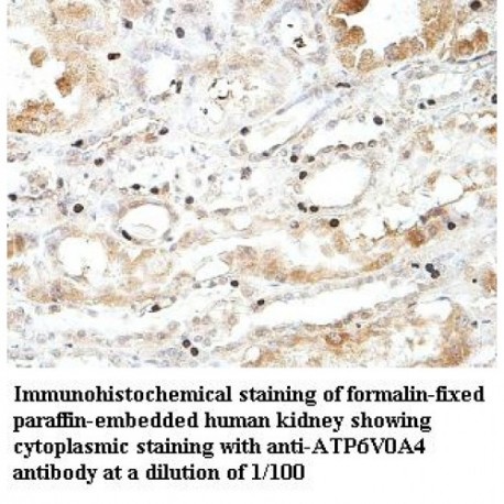 ATP6V0A4 Antibody