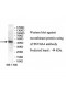 ATP6V0A4 Antibody