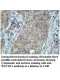 WDYHV1 Antibody