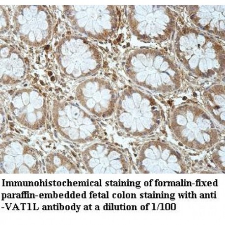 VAT1L Antibody