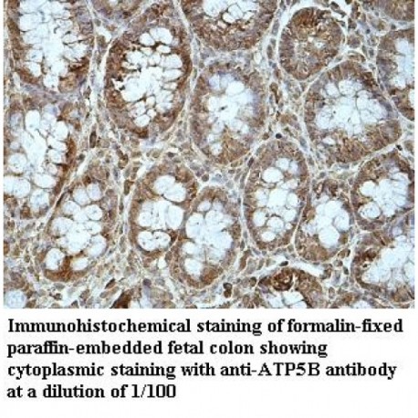 ATP5B Antibody