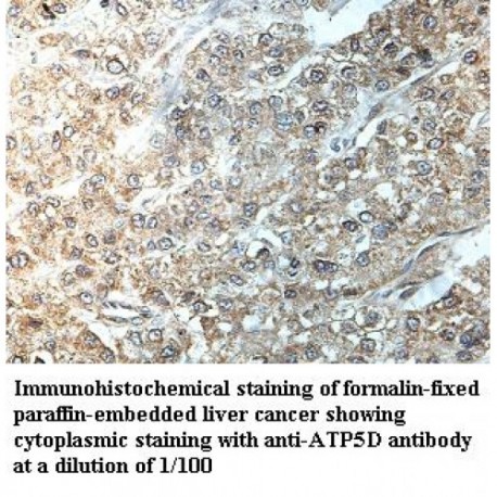 ATP5D Antibody