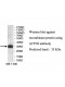 ATP5D Antibody