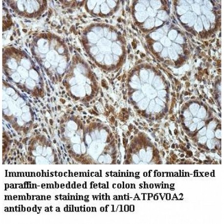 ATP6V0A2 Antibody