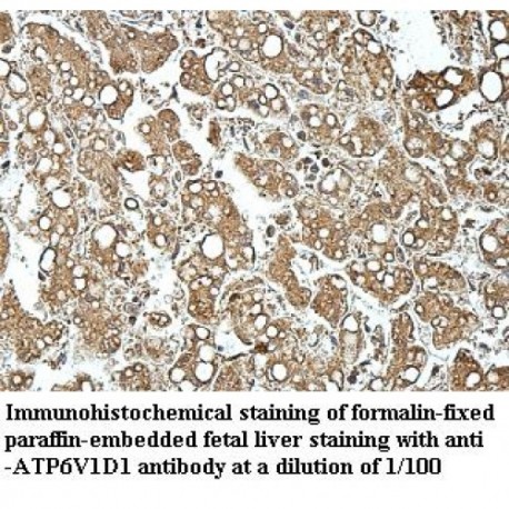 ATP6V1D1 Antibody