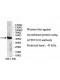 ATP6V1D1 Antibody