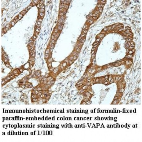 VAPA Antibody