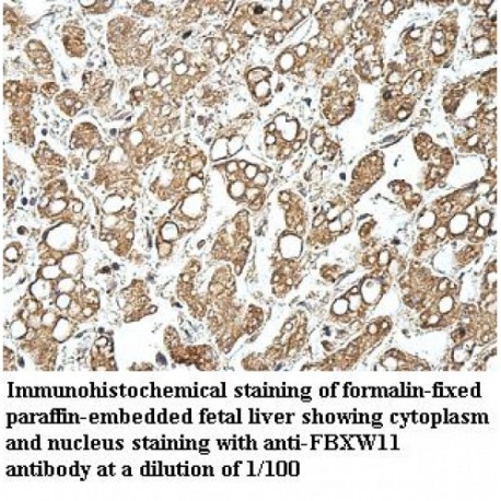 FBXW11 Antibody