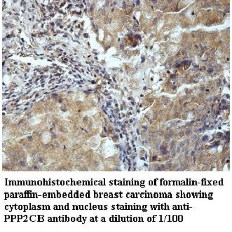 PPP2CB Antibody