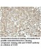VPRBP Antibody