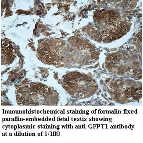 GFPT1 Antibody