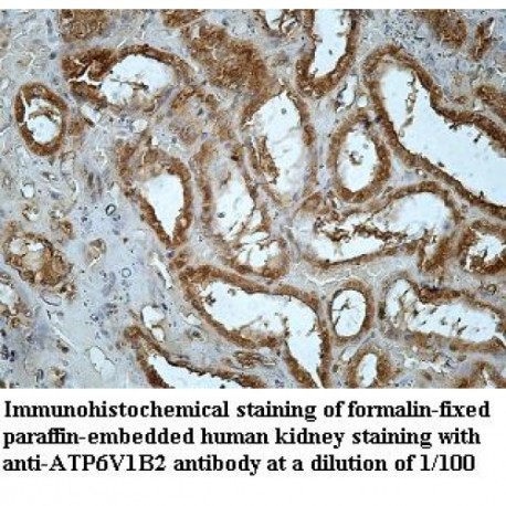 ATP6V1B2 Antibody