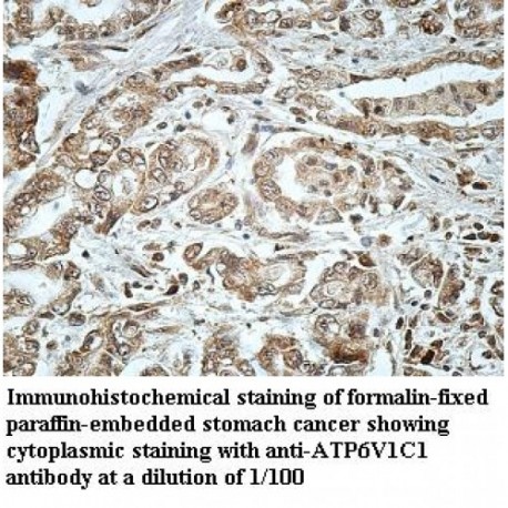 ATP6V1C1 Antibody