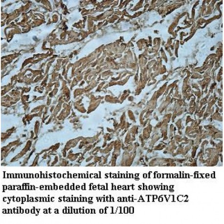 ATP6V1C2 Antibody