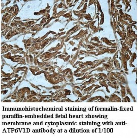 ATP6V1D Antibody