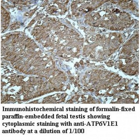 ATP6V1E1 Antibody