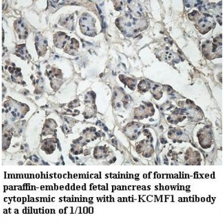 KCMF1 Antibody