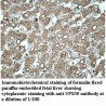 VPS39 Antibody
