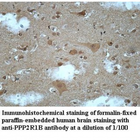 PPP2R1B Antibody