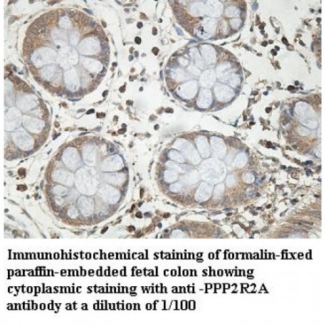 PPP2R2A Antibody